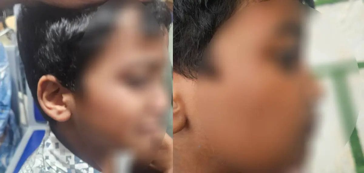 ചികിത്സയ്ക്കിടെ ഡോക്ടർ ഏഴുവയസ്സുകാരനെ മർദിച്ചതായി പരാതി; ഡോക്ടറെ അച്ഛൻ മർദിച്ചെന്ന് ആശുപത്രിയും