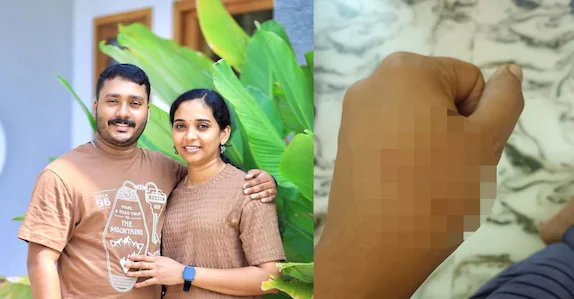 ആരതിയുടെ ദേഹത്ത് 13 മുറിവുകൾ, ‘നേരിട്ടത് ക്രൂരപീഡനം’; ഭർത്താവ് അറസ്റ്റിൽ