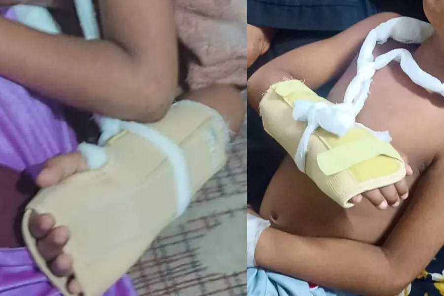 വീട്ടുമുറ്റത്ത് കളിച്ചുകൊണ്ടിരുന്ന നാലുവയസ്സുകാരനെ തെരുവുനായ കടിച്ചുകീറി; കൈയ്ക്ക് ഗുരുതര പരിക്ക്