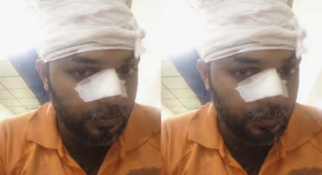 ഫുഡ് ഡെലിവറി ജീവനക്കാരന് നേരേ ആക്രമണം; തലയിലും മുഖത്തും എട്ട് തുന്നലുകൾ; ആക്രമിച്ചത് മറ്റൊരു ജീവനക്കാരൻ